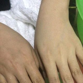Tắm trắng thảo dược