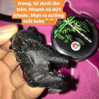 Lột mụn Lê Thanh