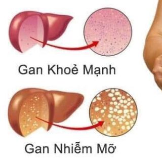 Trà giải độc gan pro