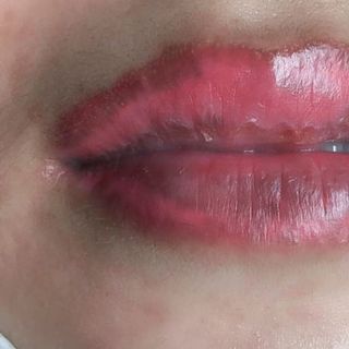 Dưỡng chuyên trị thâm loang