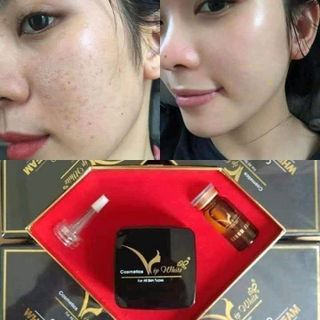 kem trị mụnđồi mồinámtàn nhang