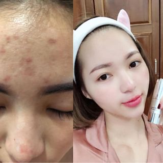 Serum Dưỡng Trẻ Hoá Căng bóng da