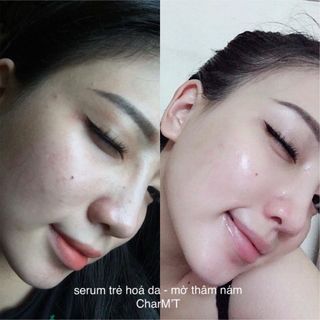 Serum Dưỡng Trẻ Hoá Căng bóng da