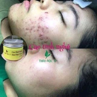 CAO TINH NGHỆ THẢO MỘC 37