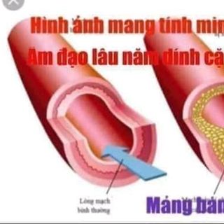 VIÊN ĐẶT PHỤ KHOA TRINH NỮ