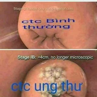 VIÊN ĐẶT PHỤ KHOA TRINH NỮ