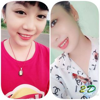 Trọn bộ 5 viên đá dán răng 25ly loại vừa