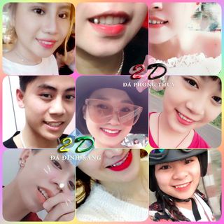 Trọn bộ 5 viên đá dán răng 25ly loại vừa