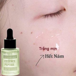 Serum trị nám DETOX BLANC
