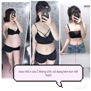 kem tan mỡ mờ rạn da Hoshiskin