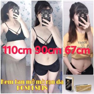 kem tan mỡ mờ rạn da Hoshiskin