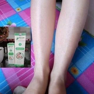 kem triệt lông quyên lara