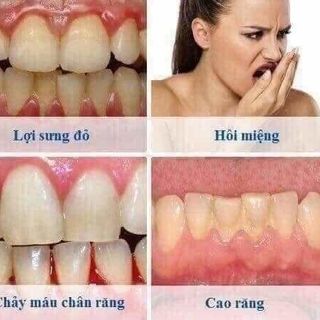 Bột trắng răng T White