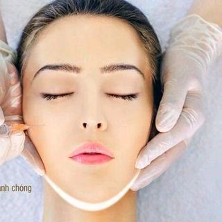 botox 100