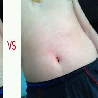 Kem tẩy lông Drose