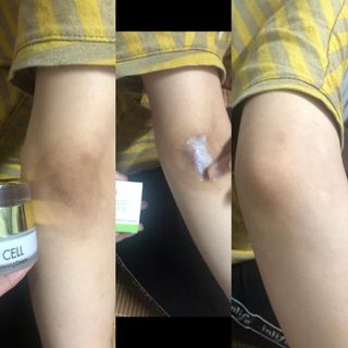 OLCELL HÚT THÂM NÁCH HÀN QUỐC