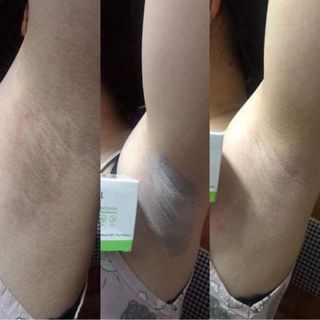 OLCELL HÚT THÂM NÁCH HÀN QUỐC