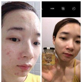 NẠ ĐẮP MẶT NGHỆ TÂY TƯƠI COLLAGEN