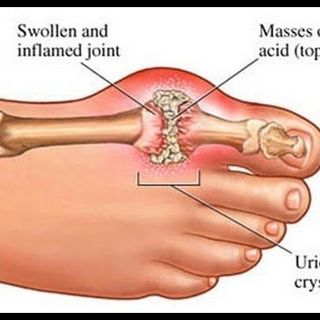 Trà thải độc ruột Natures Của Mỹ USA