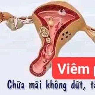 CHUYÊN SỈ VIÊN ĐẶT PHỤ KHOA