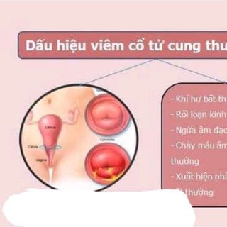 CHUYÊN SỈ VIÊN ĐẶT PHỤ KHOA