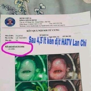 Kén Đặt Phụ Khoa Hồng Âm Tiêu Viêm Lan Chi