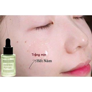 Serum trị nám Detox Blanc