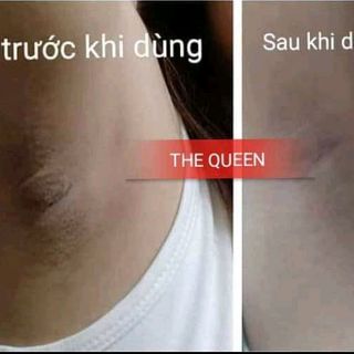 KEM HỒNG NHỦ HOA THE QUEEN