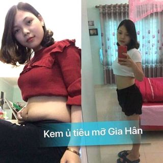 kem ủ tiêu mỡ gia hân