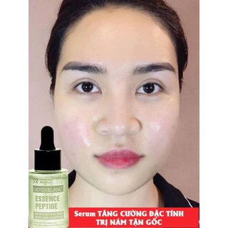Peel lộc đề trị mụn Detox Blanc