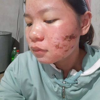 Thuốc bắc đông y tái tạo da SẮCVÂN