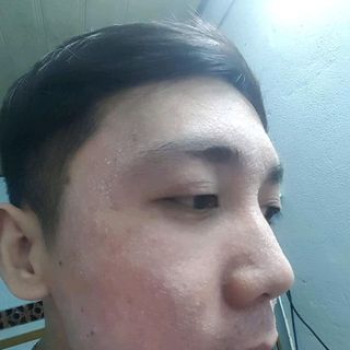 THUỐC BẮC ĐÔNG Y TÁI TẠO DA SẮCVÂN