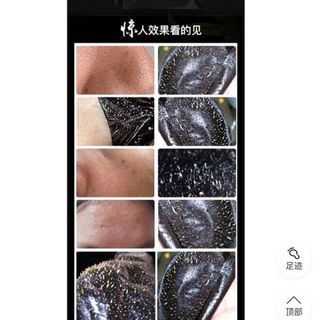 Gel lột mụn than hoạt tính Kniyea