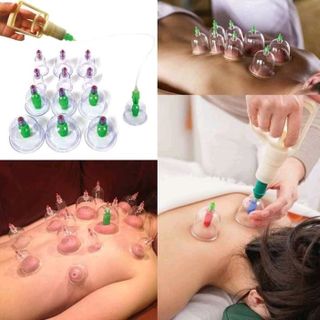 giác hơi không dùng lửa