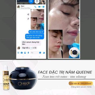 kem trị nám Queenie