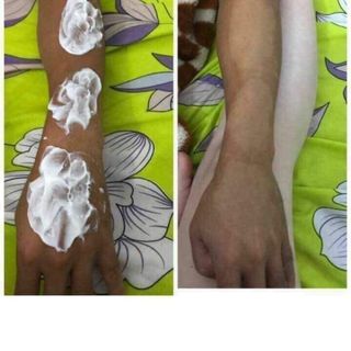 Nhuộm Trắng Da Magic