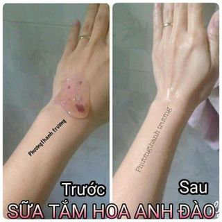 SỮA TẮM HOA ANH ĐÀO MWHITE