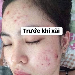 sỉ Mai Thảo Mộc nguyên chất