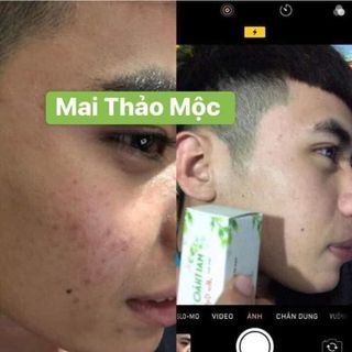 sỉ Mai Thảo Mộc nguyên chất