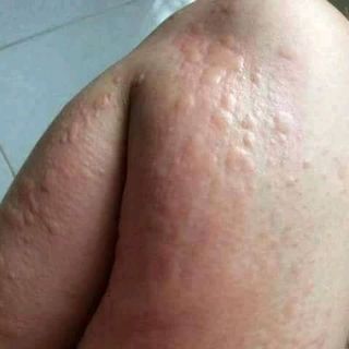 Cao thảo mộc trị đau khớp người già