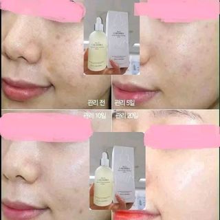 Tế bào gốc Plus Laksmira