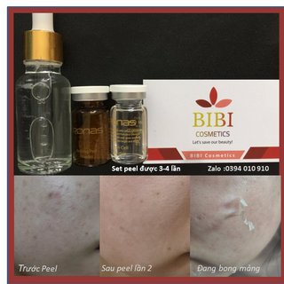 Vi Kim Tảo Biển Ronas Resting Peel Korea