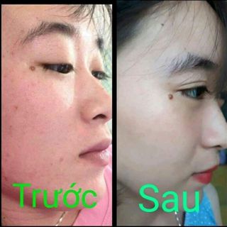 Sữa rửa mặt Gon