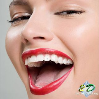 Đá đính răng chân nhọn 25ly