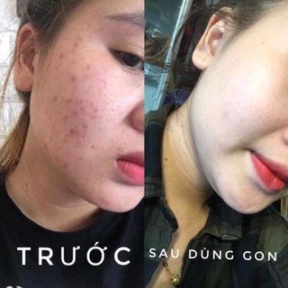 Sữa rửa mặt Gon