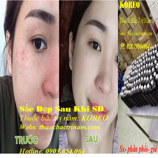 thuốc bắc trị nám tìm đối tác kinh doanh cty cp đông dược KOREO