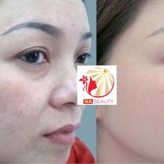serum tái tạo da hồng sâm Na beauty