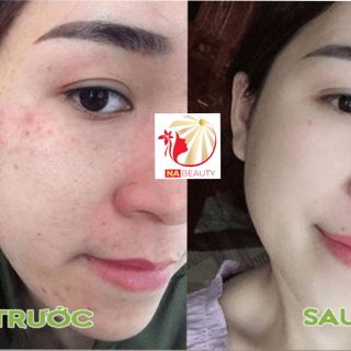 serum tái tạo da hồng sâm Na beauty