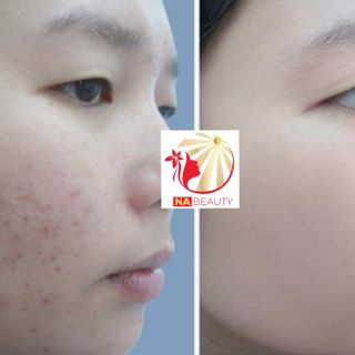 serum tái tạo da hồng sâm Na beauty