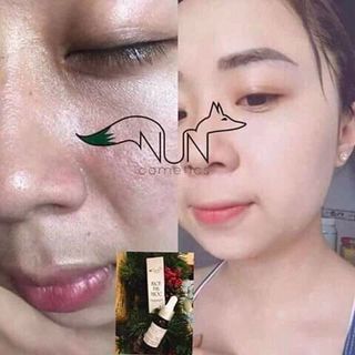 SERUM bạch đan dược